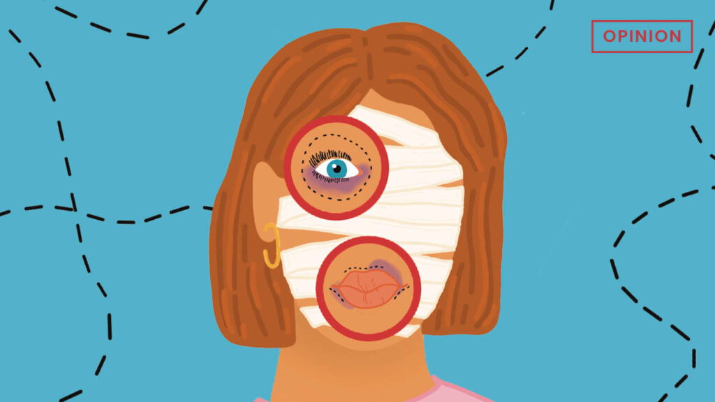 Beauty or Botched: Plastic surgery creates a beauty standard that is impossible to live up to
